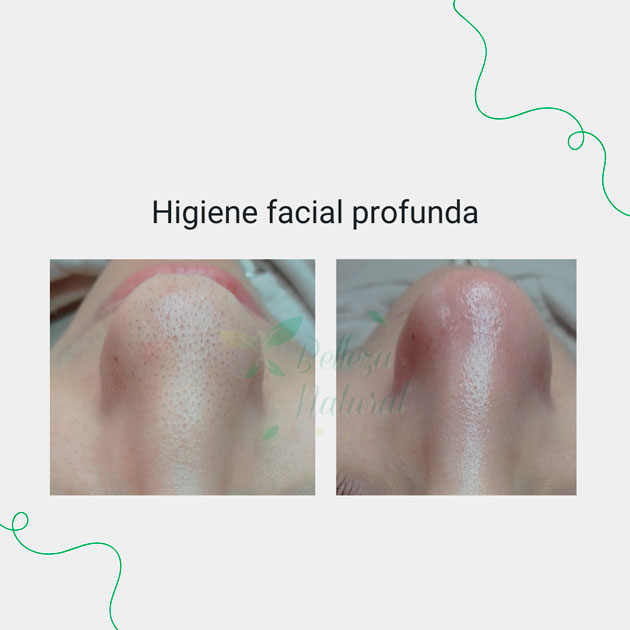 Higiene facial profunda